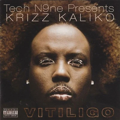 Krizz KalikoVitiligo